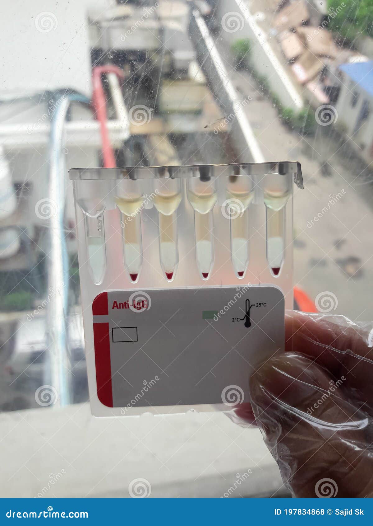 igg-cross-matching-card-crossmatching-compatibility-testing-between-patient-blood-and-donor