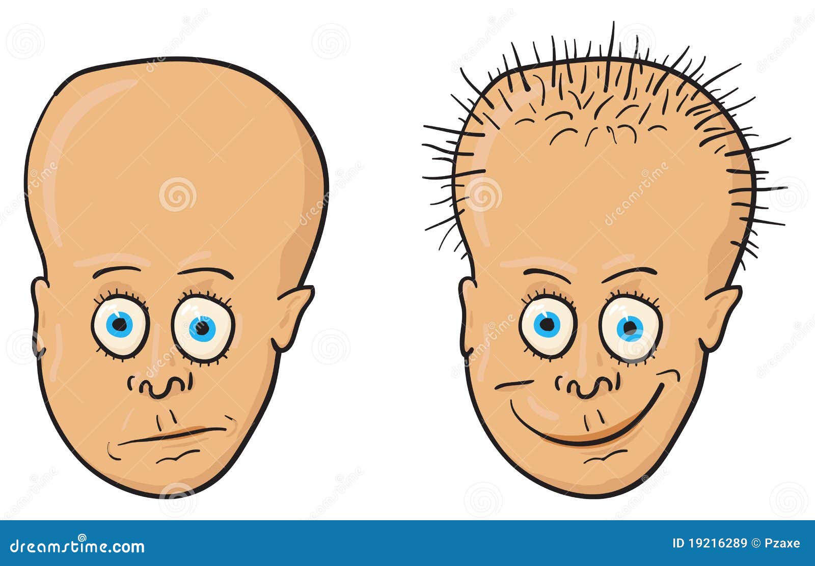 Illustratie - Patiënt Met Een Kaal Hoofd En Een Haar Vector Illustratie - Illustration Of Mannetje, Komisch: 19216289