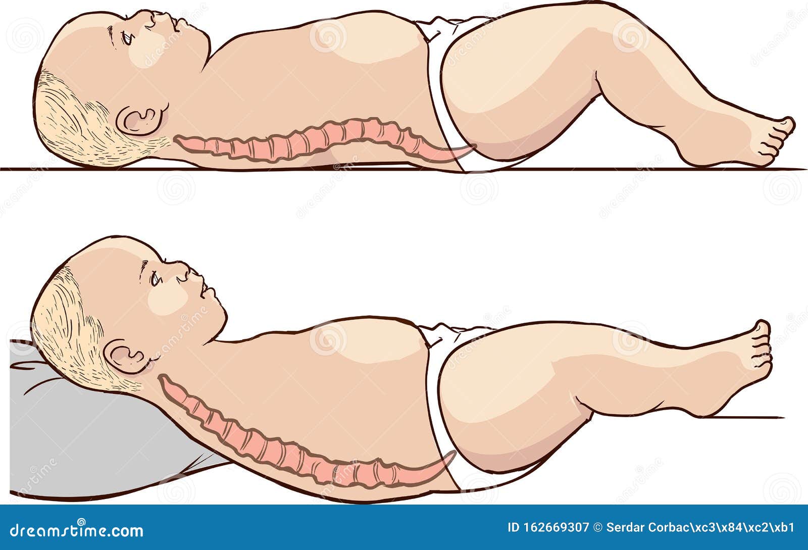 Illustration Of Baby Spine And Correct Lying Position Stock Vector Illustration Of Musculoskeletal Painful Illustration Of Baby Spine And Correct Lying Position Stock Vector Illustration Of Musculoskeletal Painful
