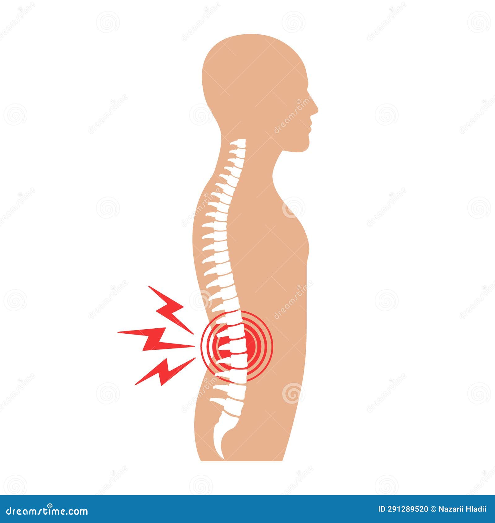 Illustration of Back Pain. Spine Ache Stock Vector - Illustration of ...