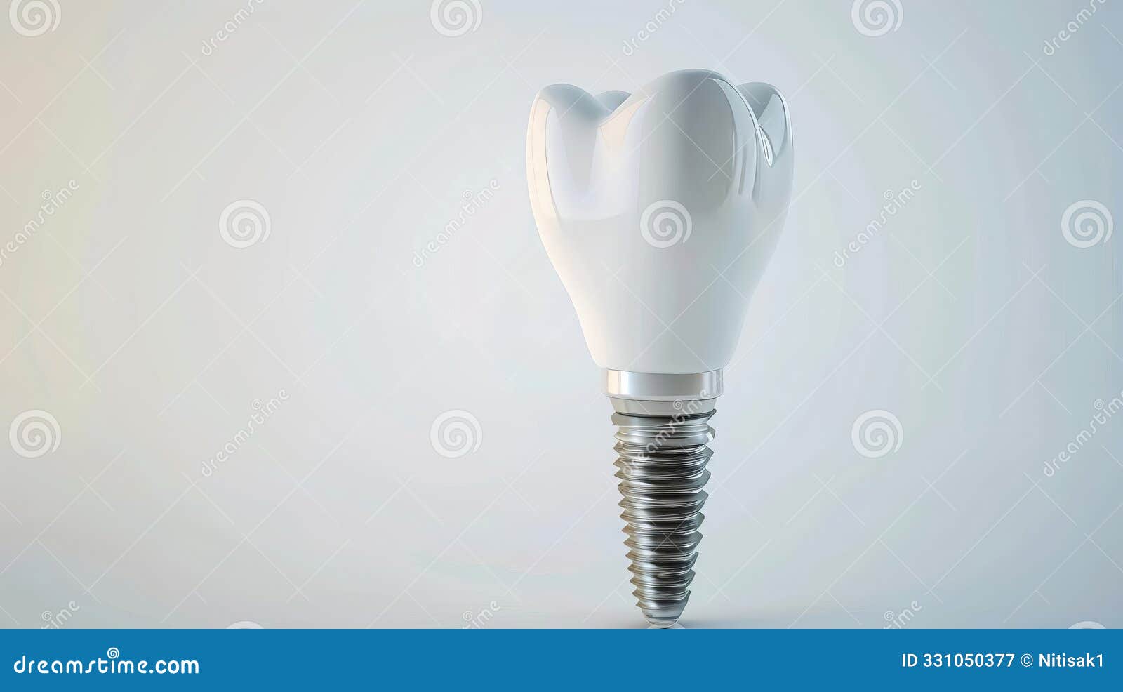  of a dental implant on a white background illustrating its integration with the jawbone