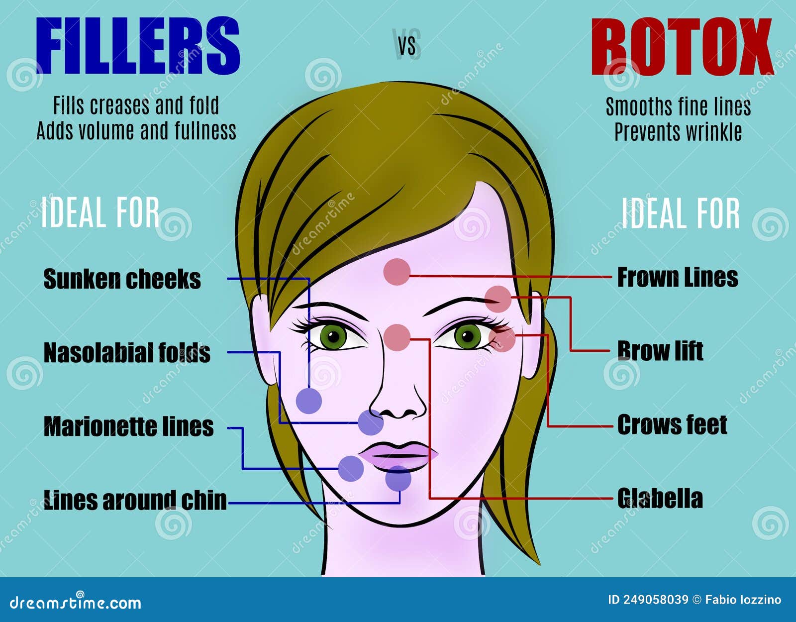  about dermal fillers and botox ares. injections. cosmetology. beauty