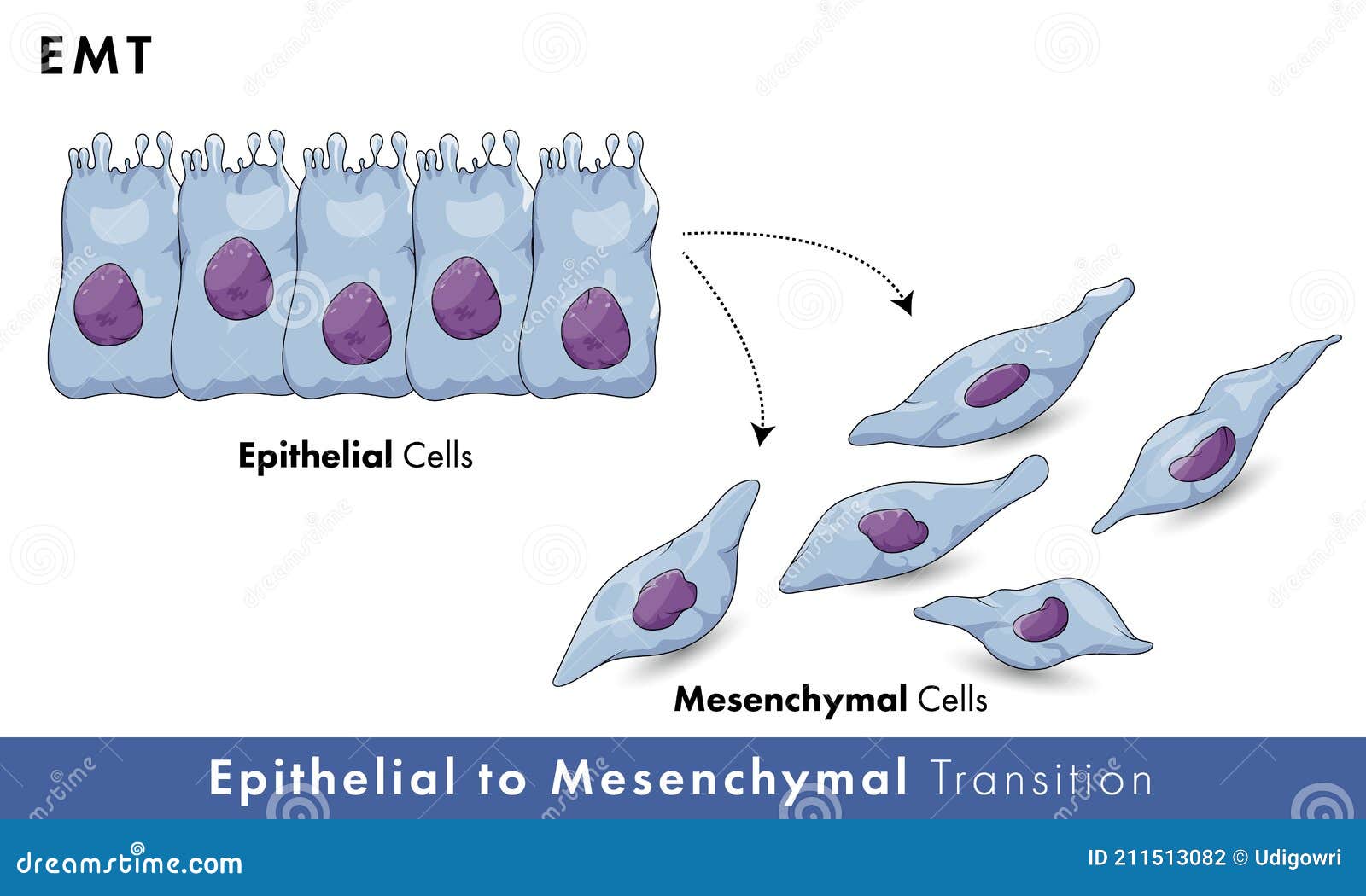 epithelial to mesenchymal transition