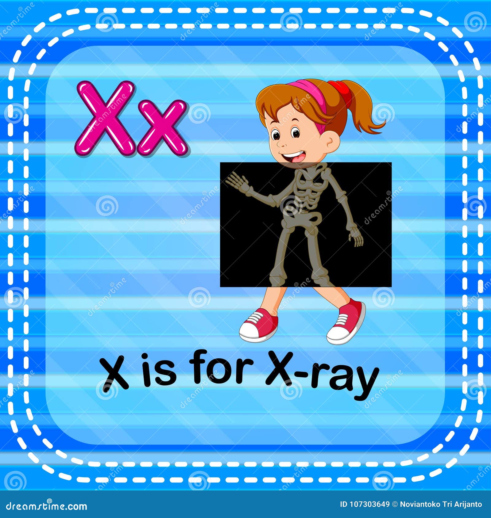flashcard letter x is for x-ray