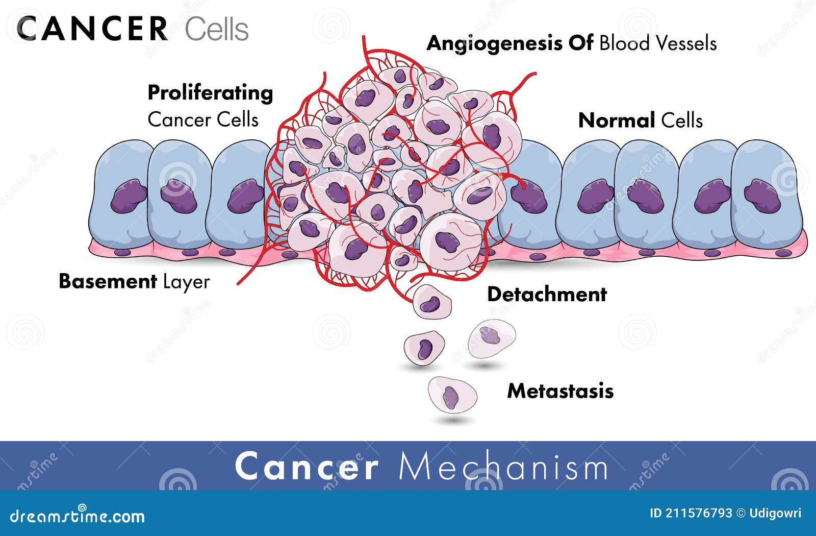 angiogenesis of blood vessels in tumor