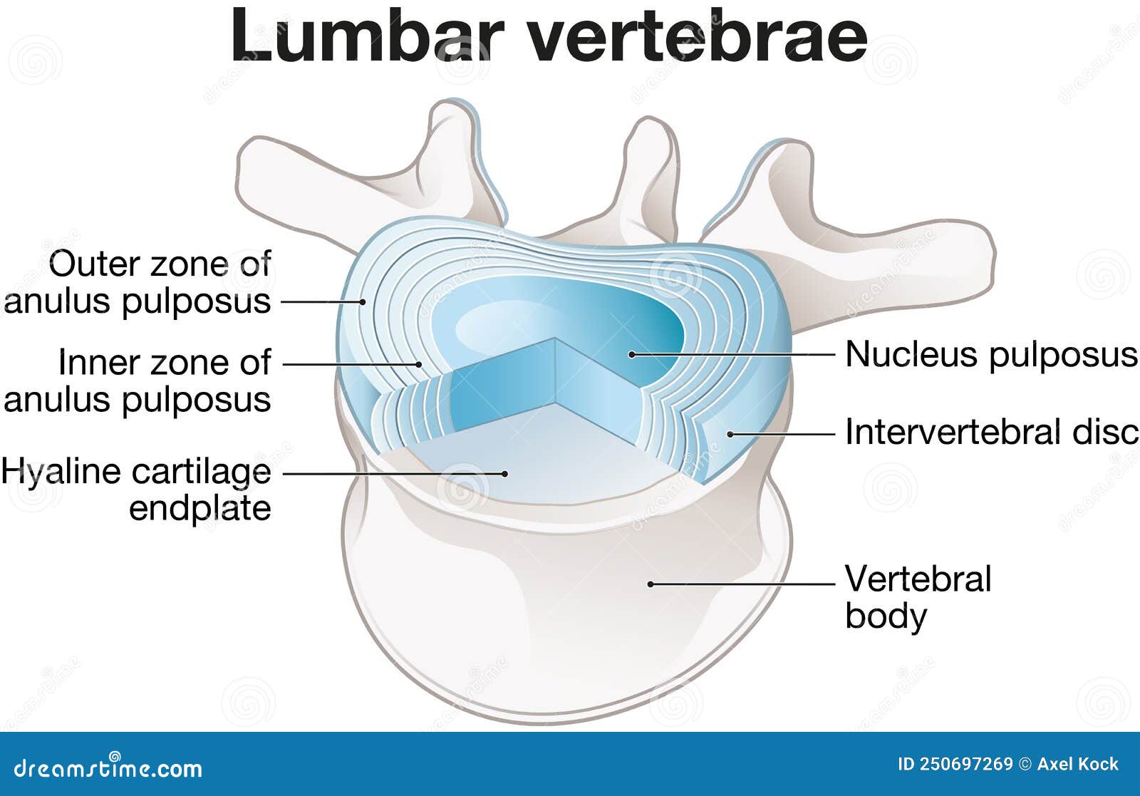 healthy lumbar vertebrae and intervertebral disc. labeled 
