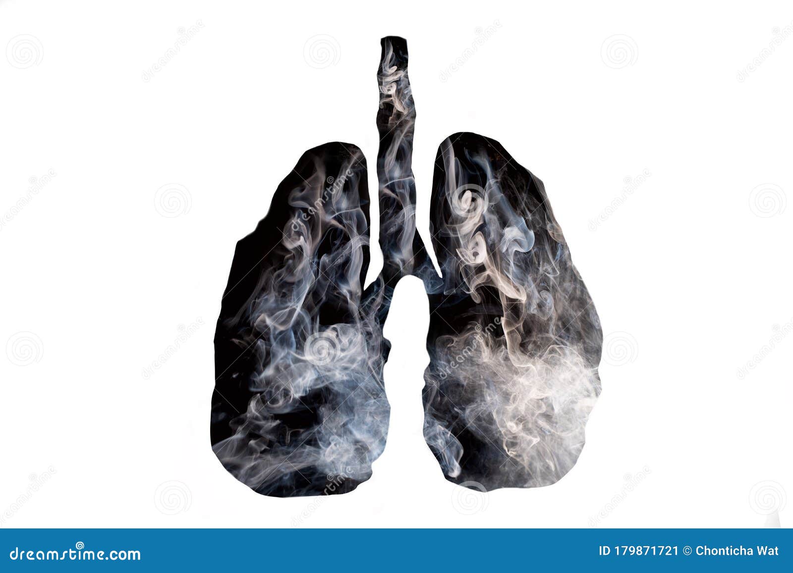 这个部位很黑，最好去检查一下肺部，肺癌可能已经找上你_吸烟史