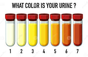 Urine Color Chart Vector Illustration CartoonDealer 230706296