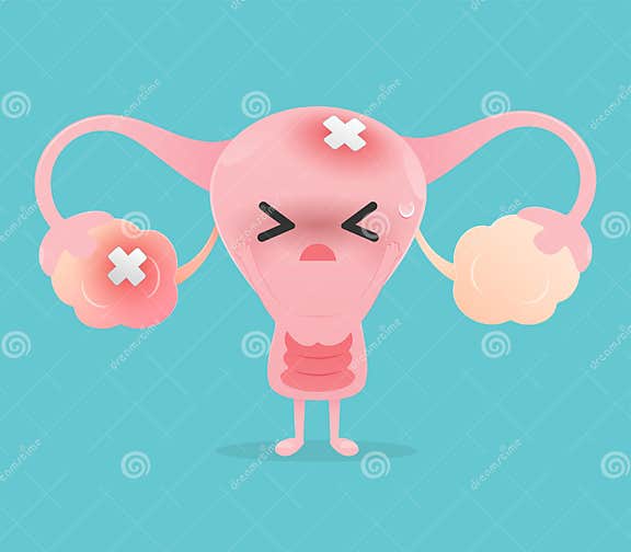 Illustration Uterus Inflamed Ovary Against a Blue Background. Stock ...