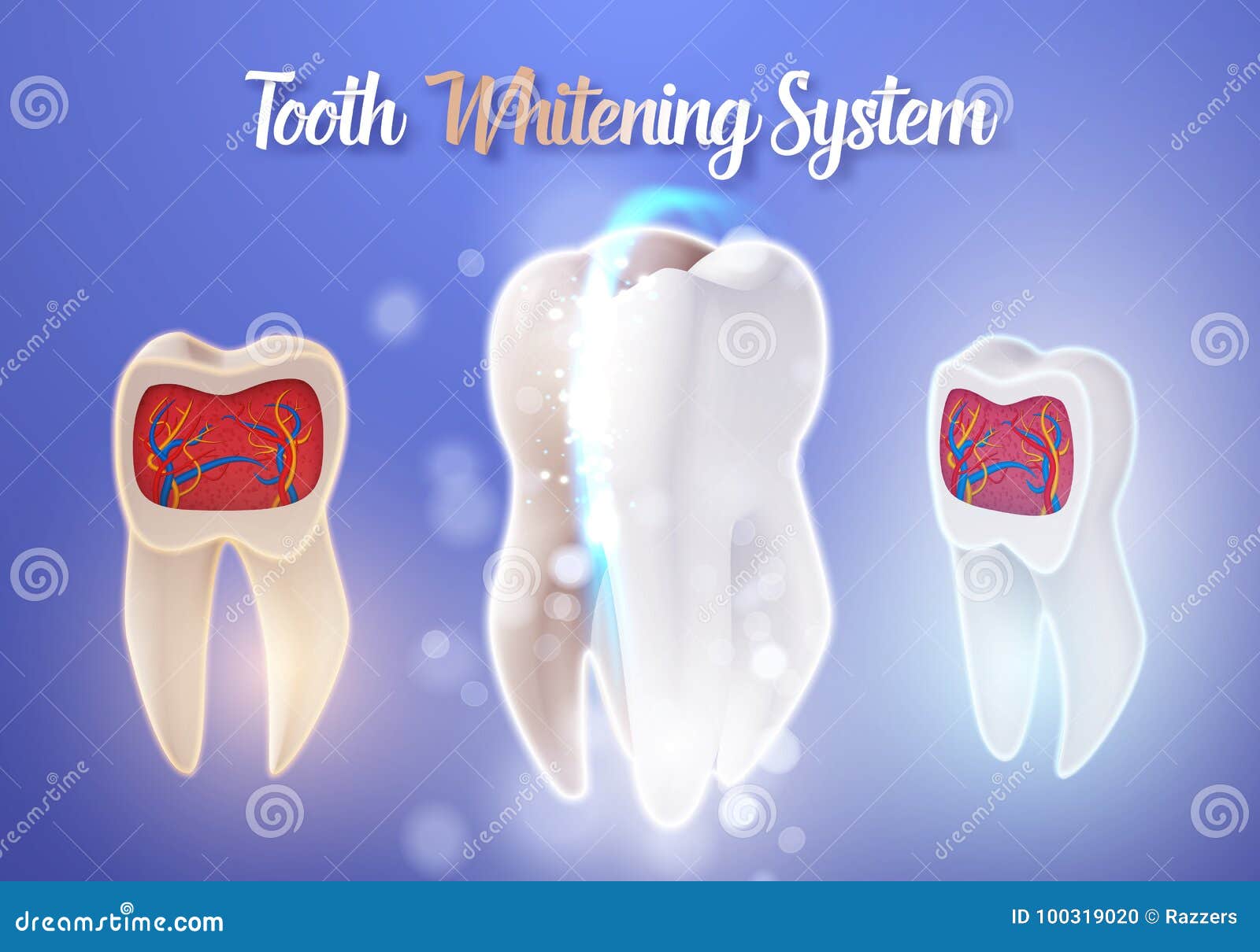 Vector Teeth Cleaning Process. 3D Realistic Vector Teeth Whitening Process Stock Vector