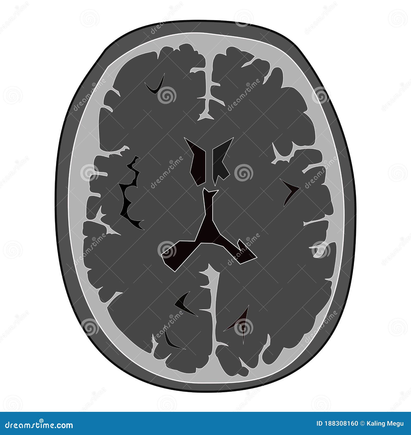 Illustrative Picture Of Normal Ct Scan Of Head Of Human Brain Stock