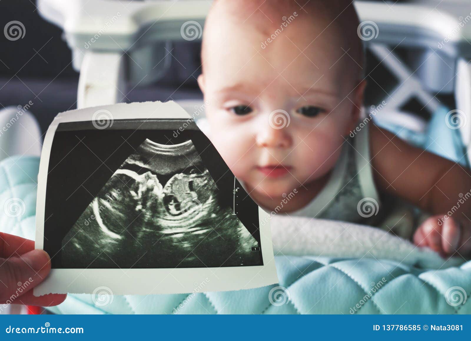 Image D Ultrason A La eme Semaine De La Grossesse A L Arriere Plan Est Un Bebe De Bebe De 6 Mois Avant Et Maintenant Foyer Sele Image Stock Image Du Image Abord Image D Ultrason A La eme Semaine De La Grossesse A L Arriere Plan Est Un Bebe De Bebe De 6 Mois Avant Et Maintenant Foyer Sele Image Stock Image Du Image Abord