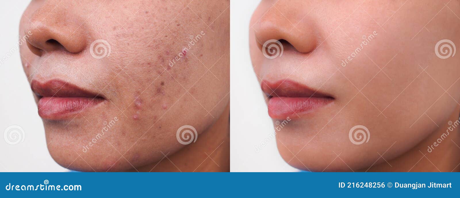 1 6 Dark Spot Face Photos Free Royalty Free Stock Photos From Dreamstime 1 6 Dark Spot Face Photos Free Royalty Free Stock Photos From Dreamstime