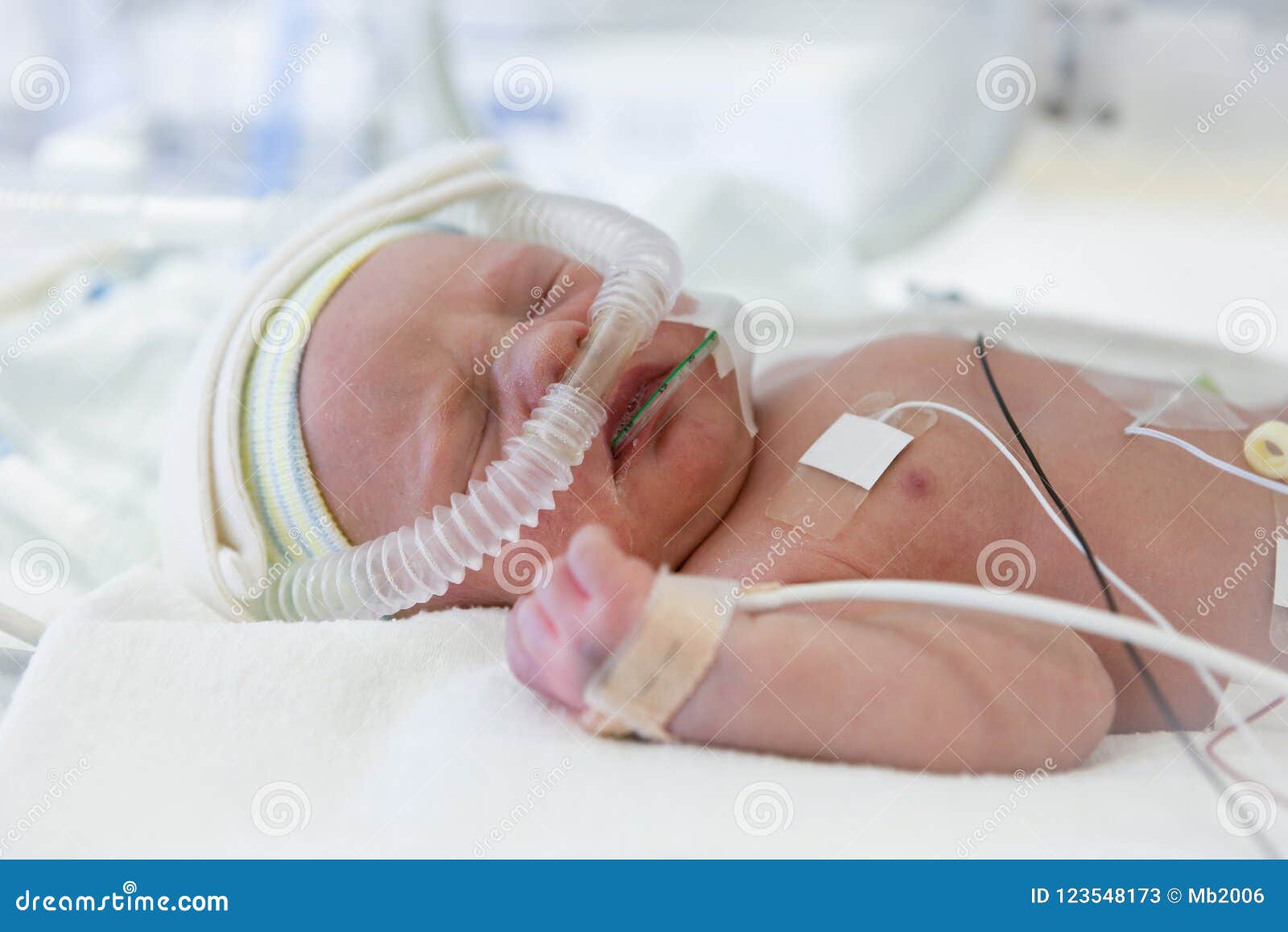 premature baby in incubator