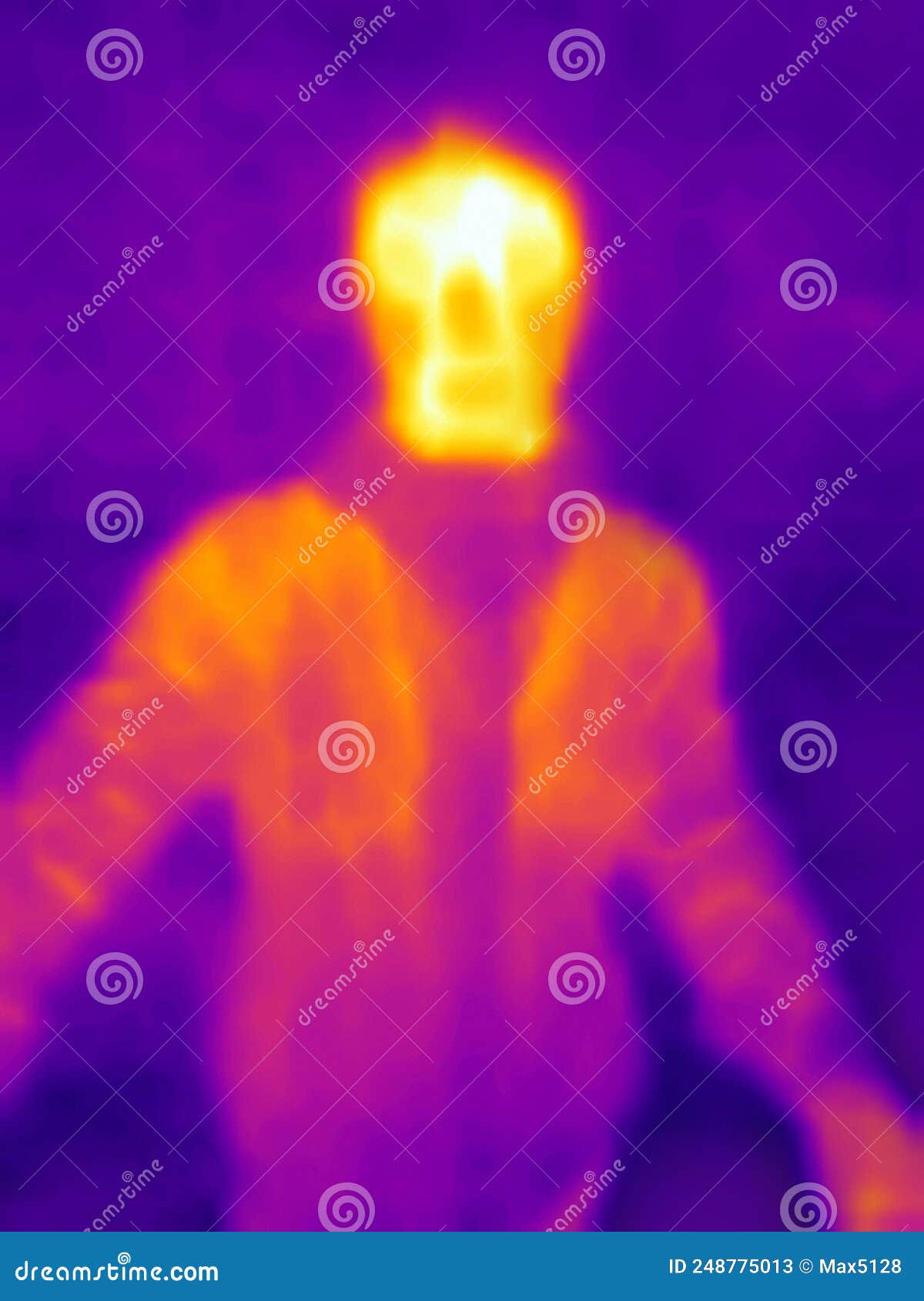 The Image from the Thermal Imager Device Stock Image Image of fever