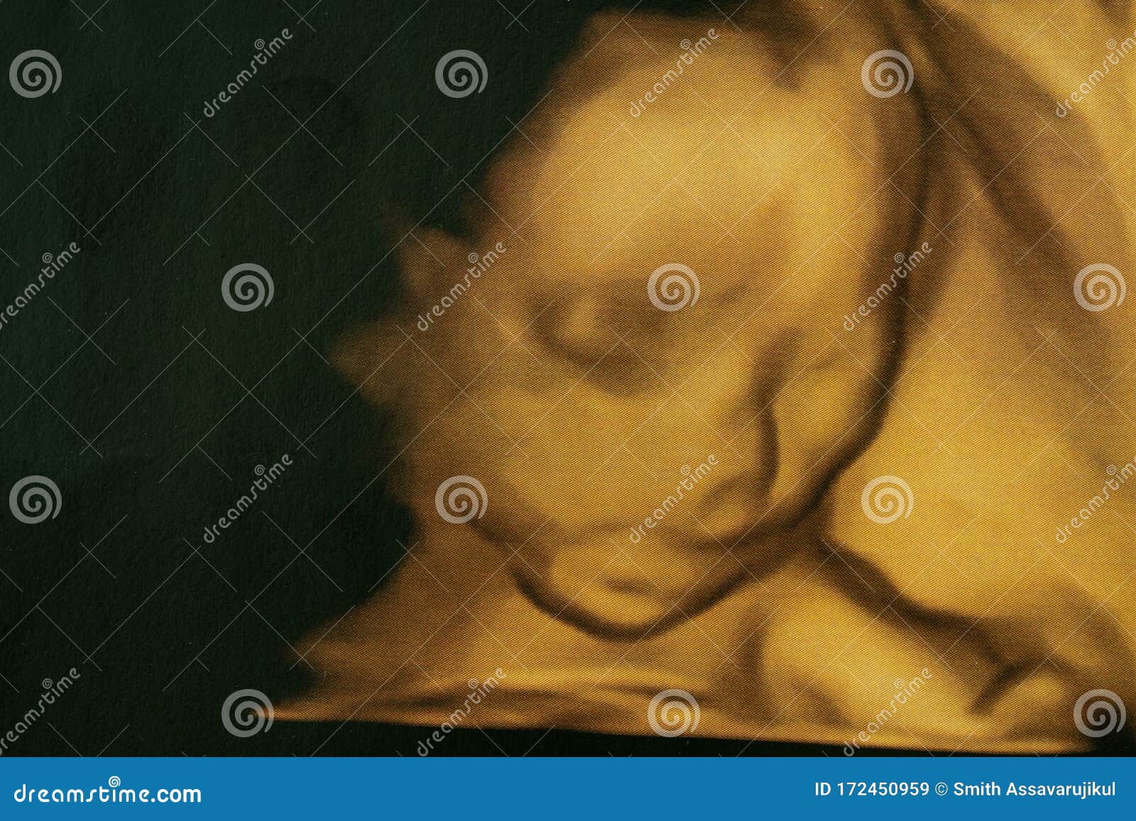 the image of ultrasound 3d/4d of baby in mother`s womb or pregnancy