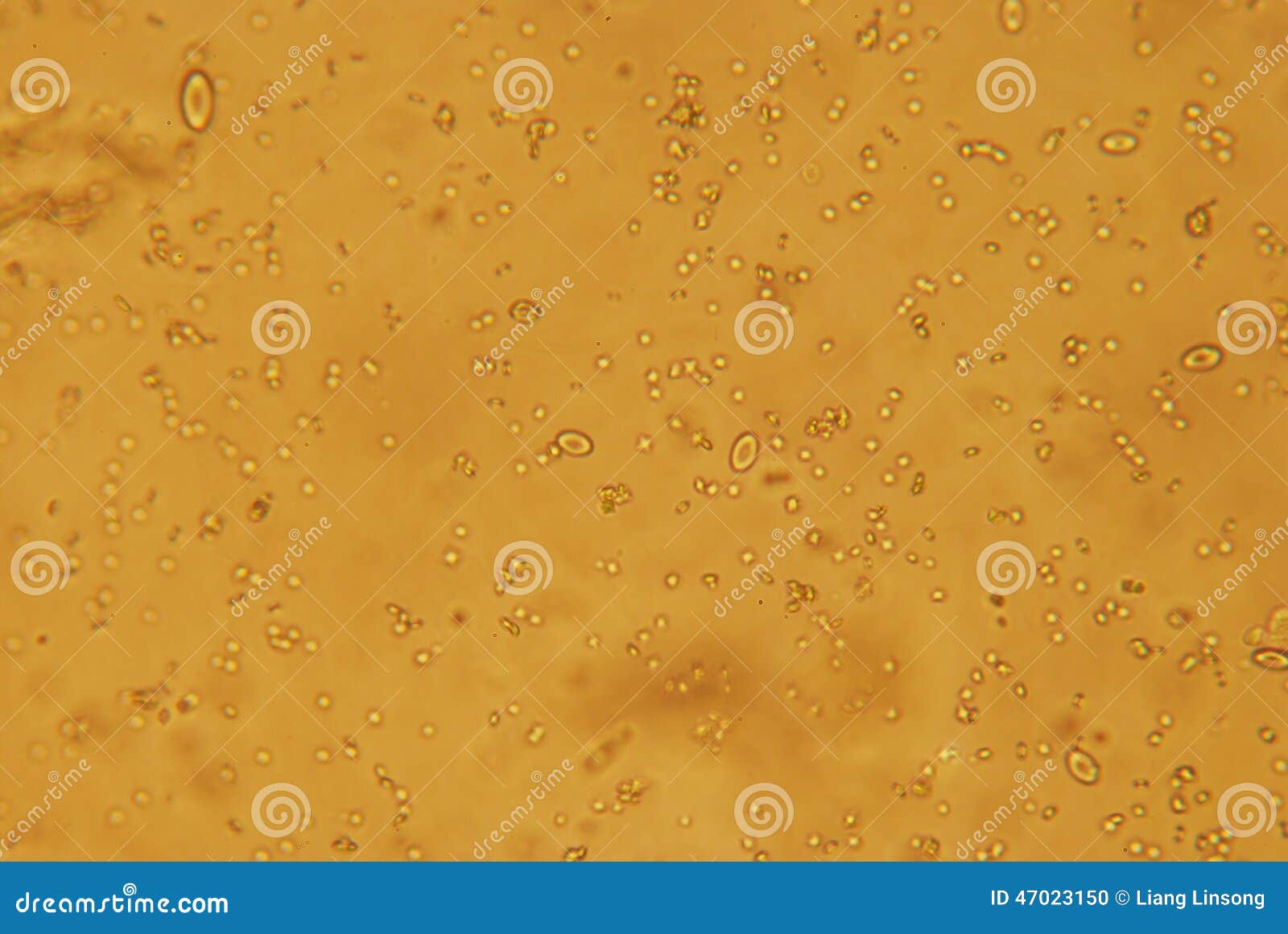 Image of Urine Under Microscope Stock Photo Image of cell, medical 47023150