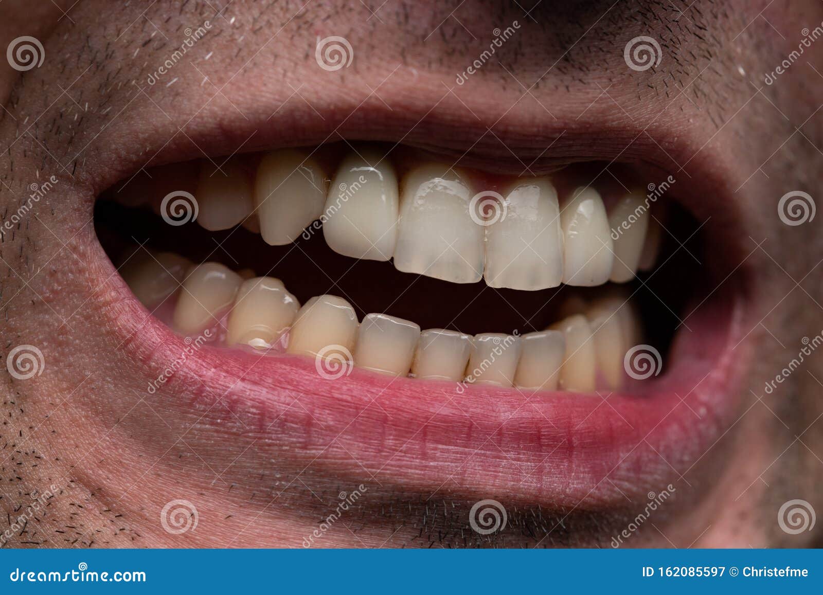 Image of Young Man with Open Mouth, Showing Teeth Stock Image - Image