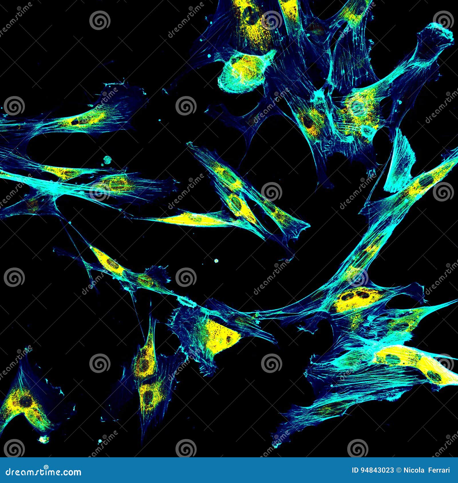 immunofluorescence confocal imaging of fibroblasts
