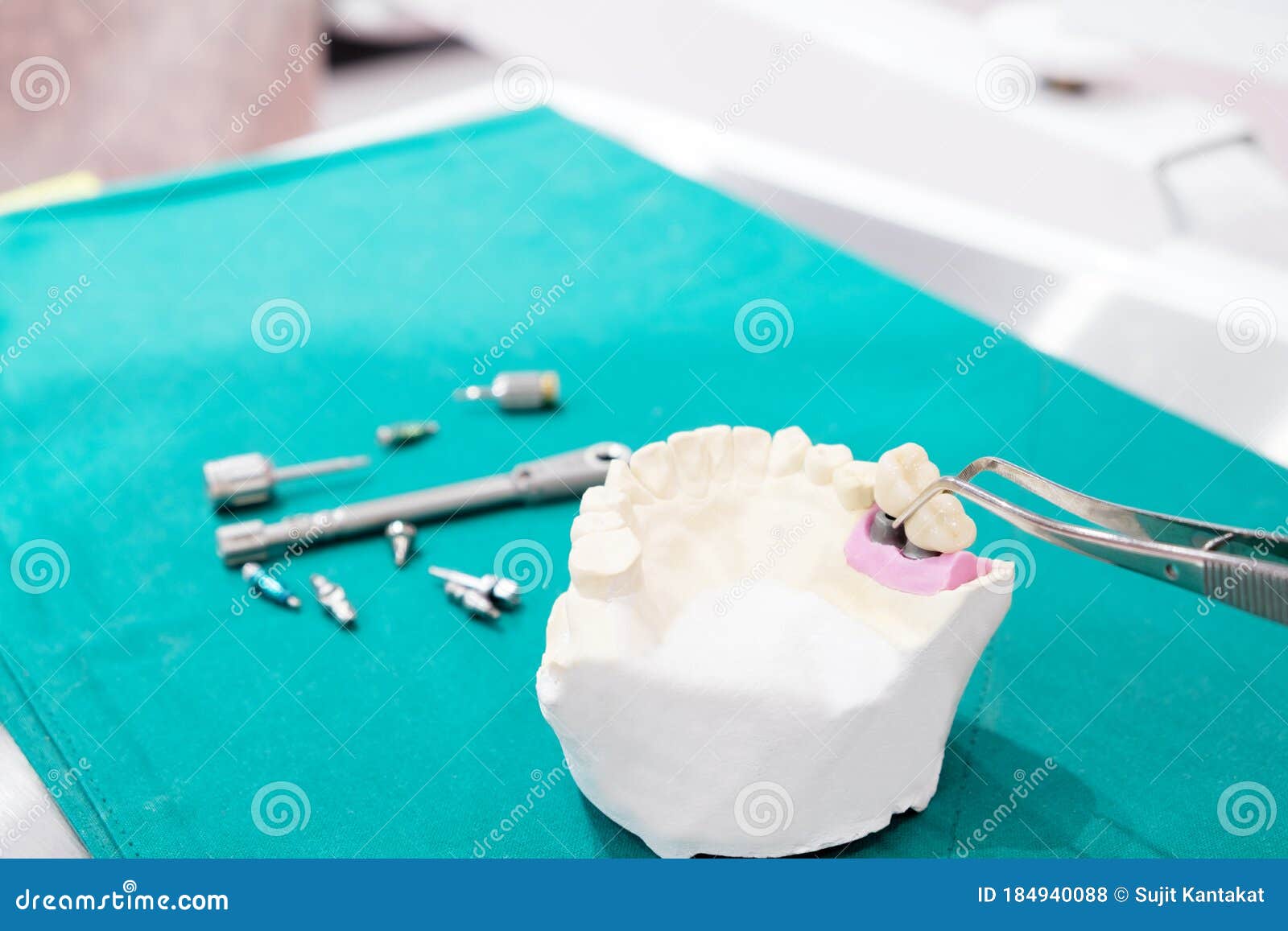 Implant and Prosthodontic Model. Stock Photo Image of medical