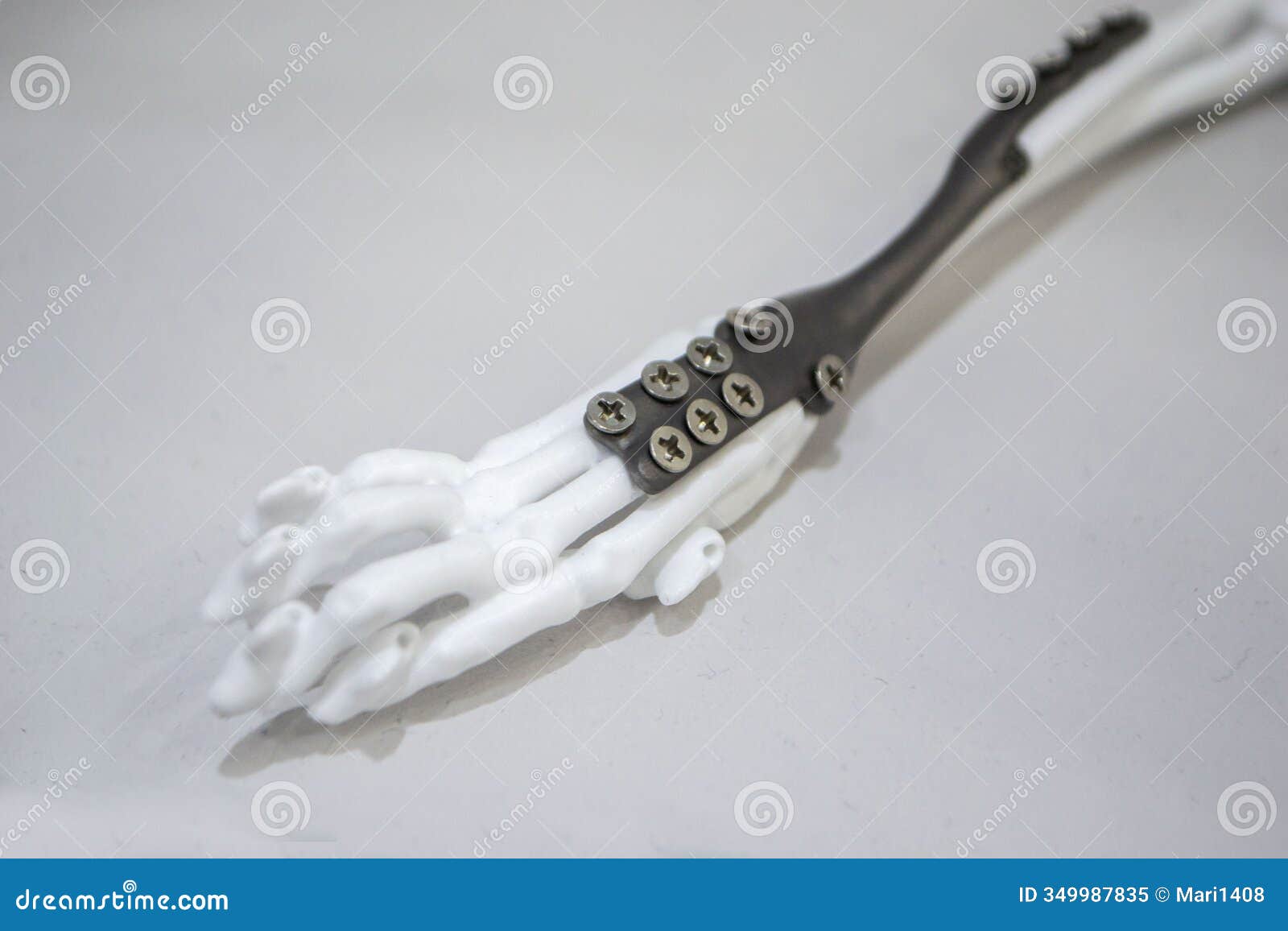 implants and prostheses printed on 3d printer from biocompatible titanium powder