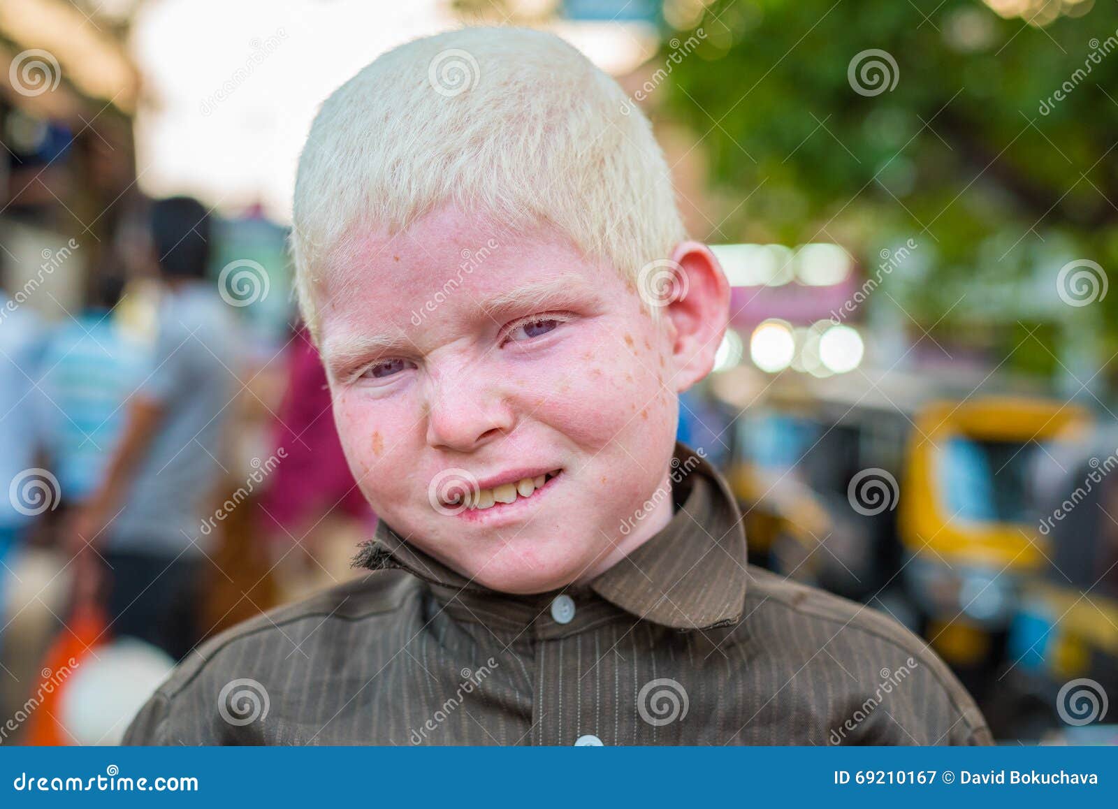 albino indian person