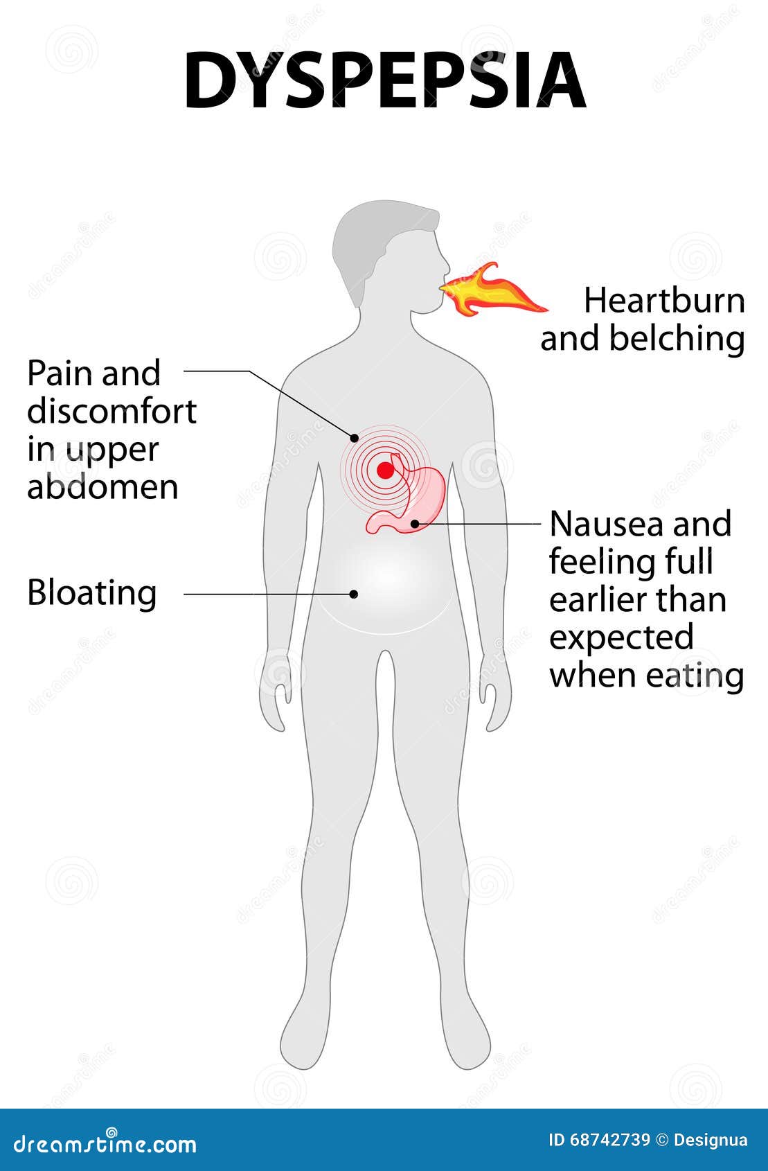 indigestion or dyspepsia