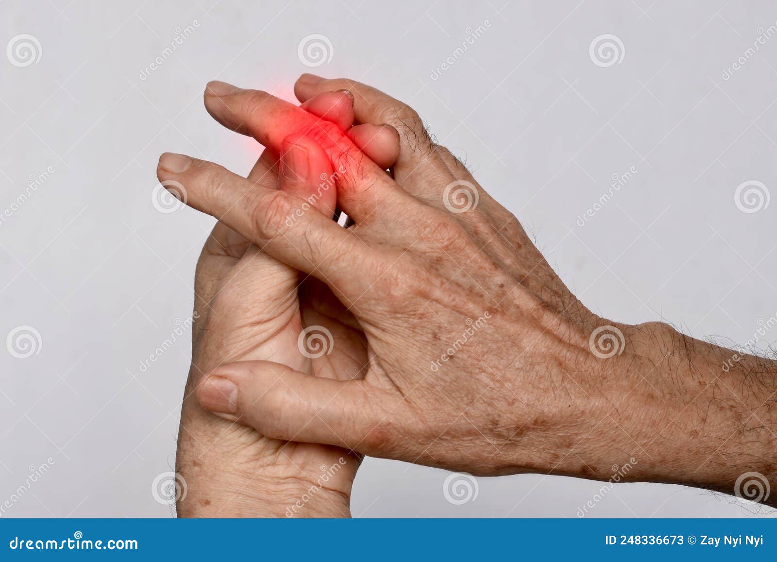 inflammation of asian man middle finger and hand. concept of arthritis or cellulitis