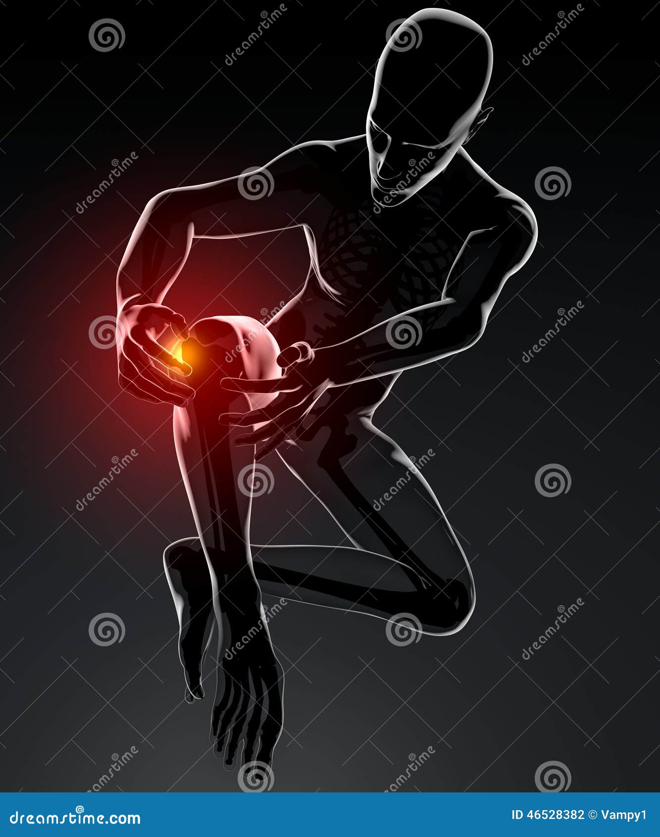 Inflammation of Knee Pain Skeleton Xray Stock Illustration