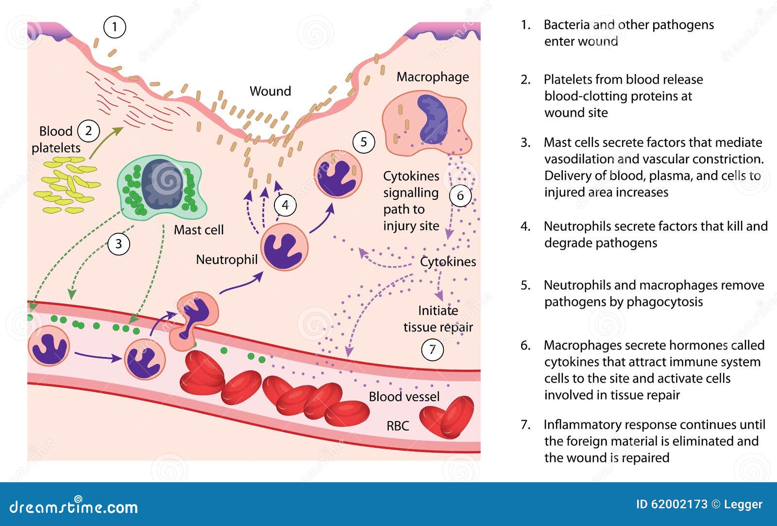 inflammation and tissue repair