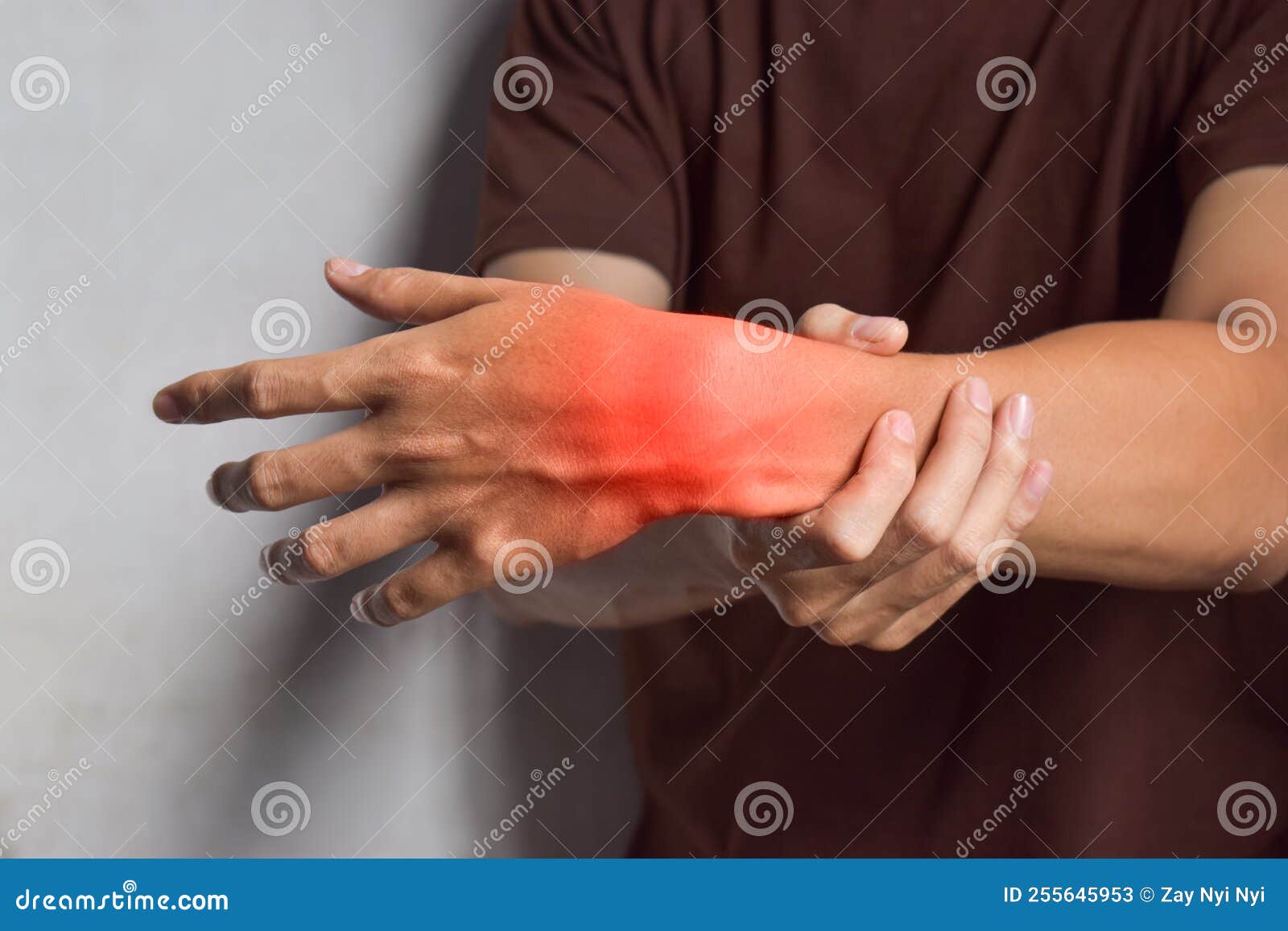 Inflammation of Wrist. Concept of Joint Pain or Osteoarthritis Stock