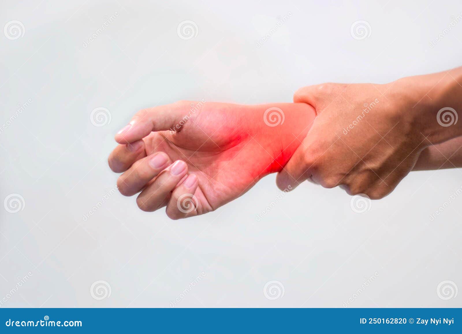 Inflammation of Wrist. Concept of Joint Pain or Osteoarthritis Stock