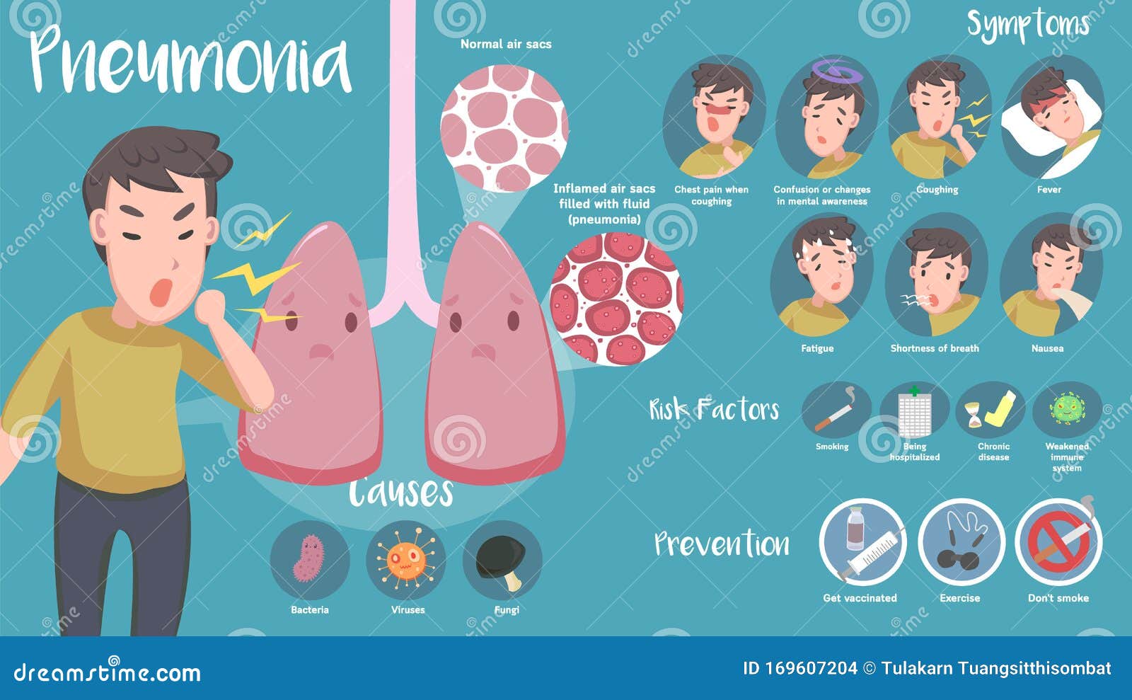 Infographic of Pneumonia Disease Stock Vector Illustration of mucus