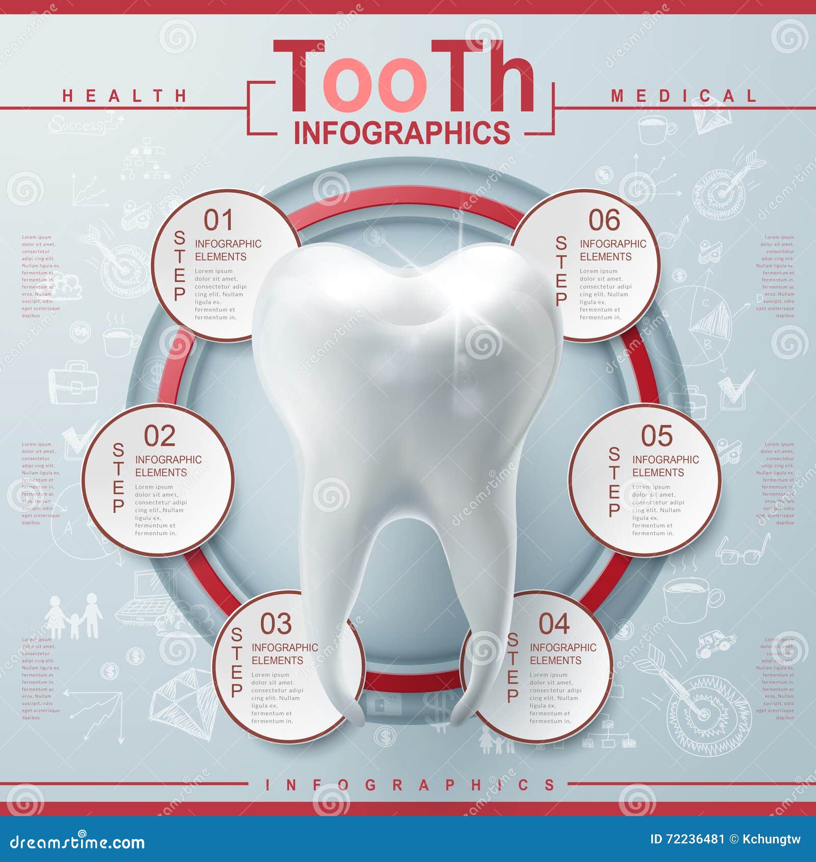 Infographic Dental Implant Structure Info Poster Cartoon Vector
