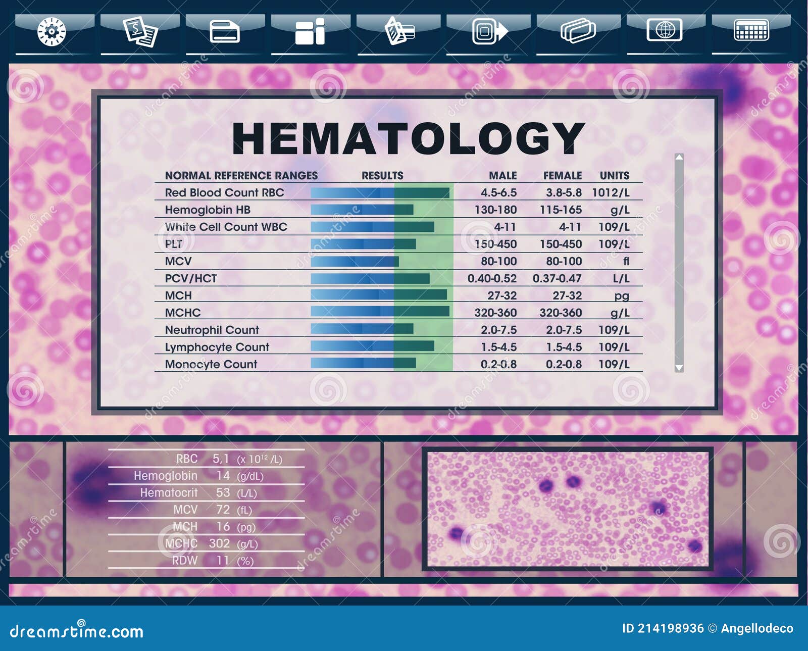 infographic of a ui screen with medical report from hematology laboratory.  of user interface with results of blood