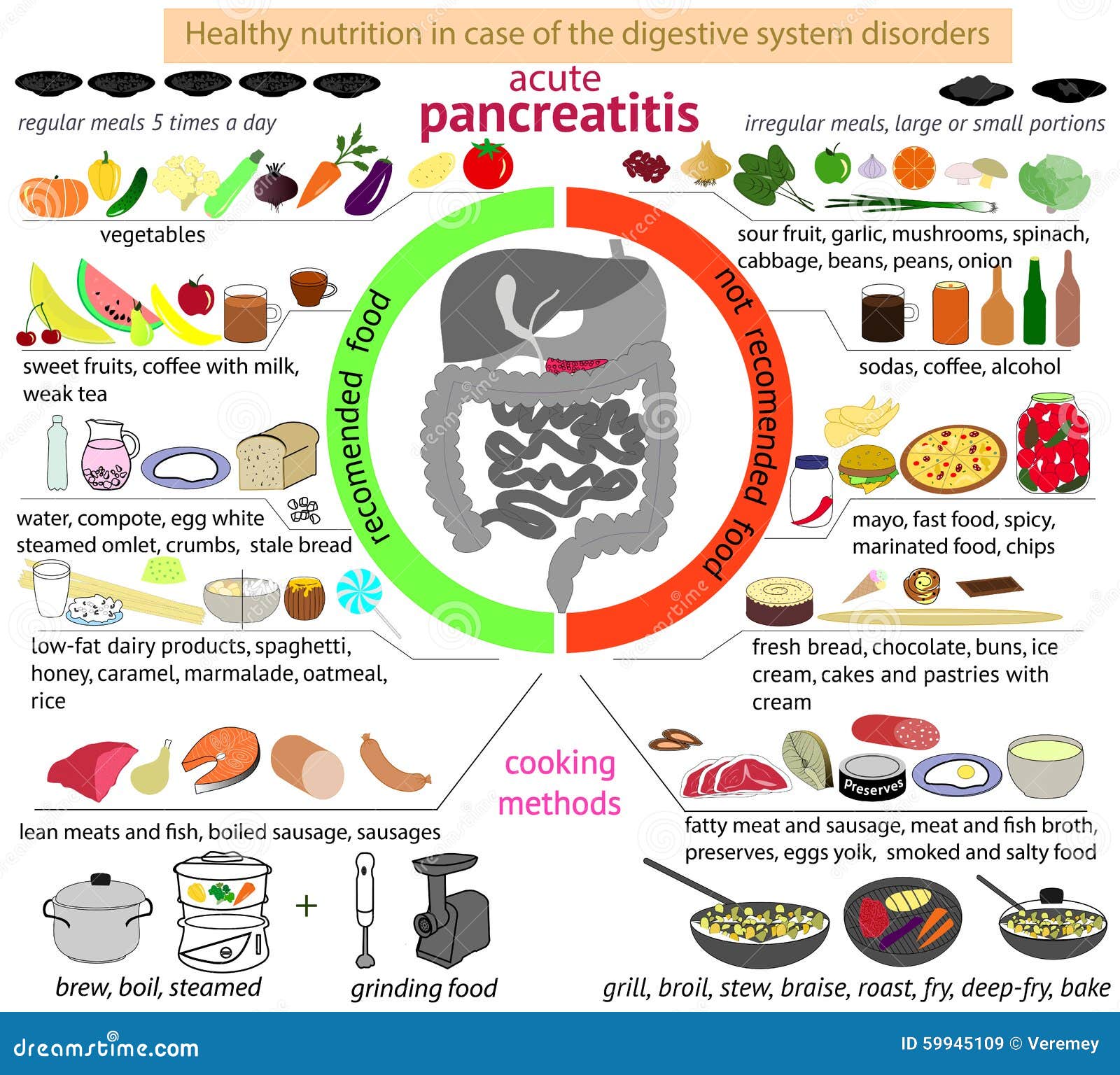 Infographics Nutrition In Case Of Pancreatitis. Stock Vector