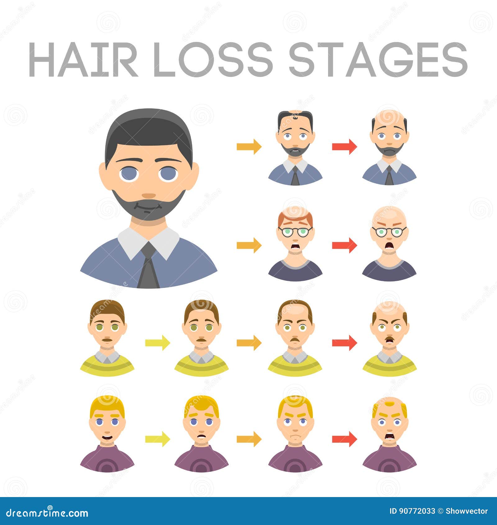 Farjo Hair Institute  Do you know the types of Male Pattern Baldness Read  more here httpswwwfarjocomabouthairlossmalepatternbaldness   Facebook
