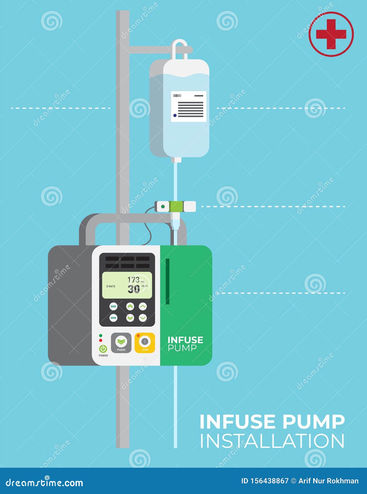 infuse pump installation medical equipment