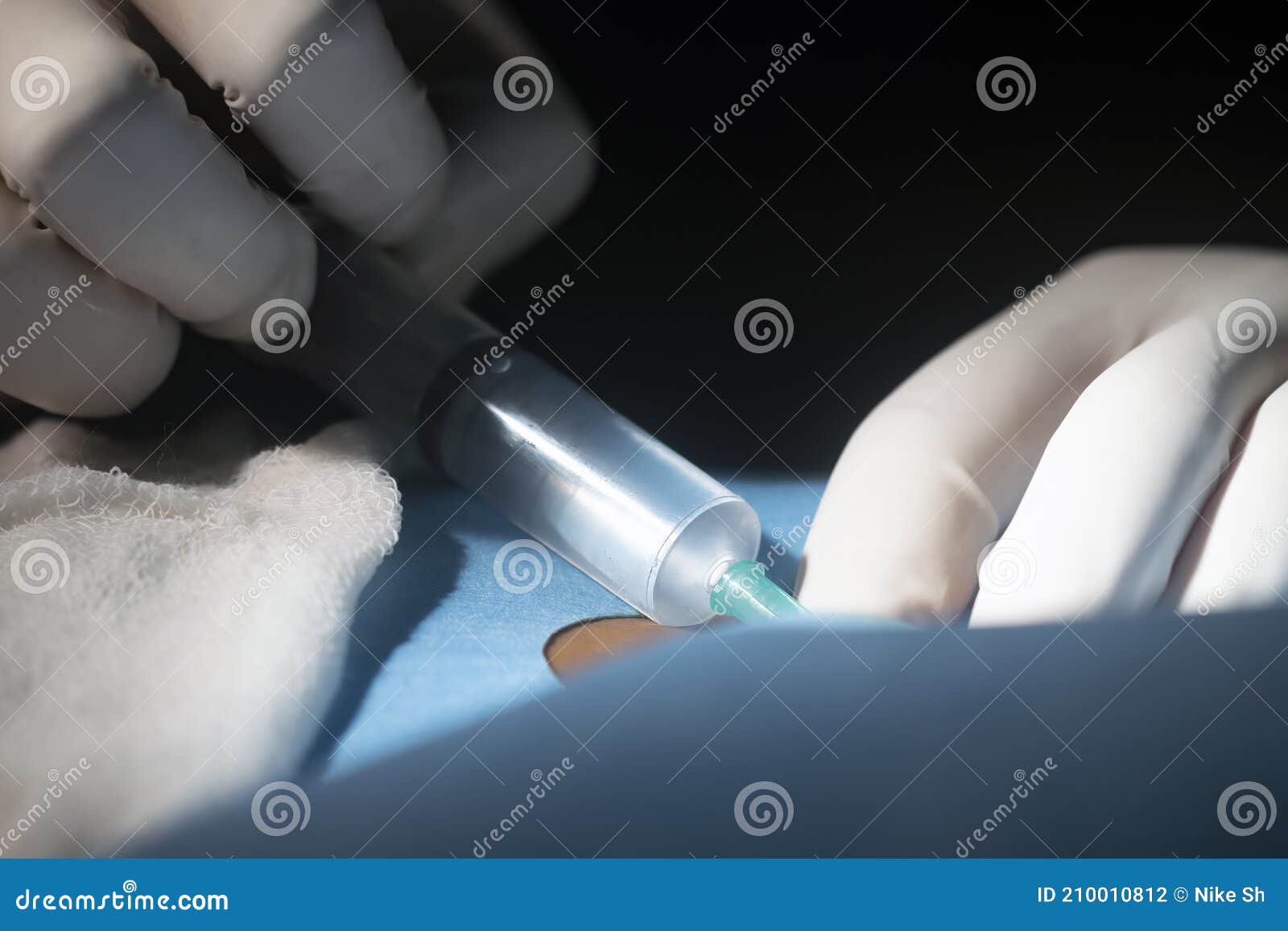 injecting local anesthesia