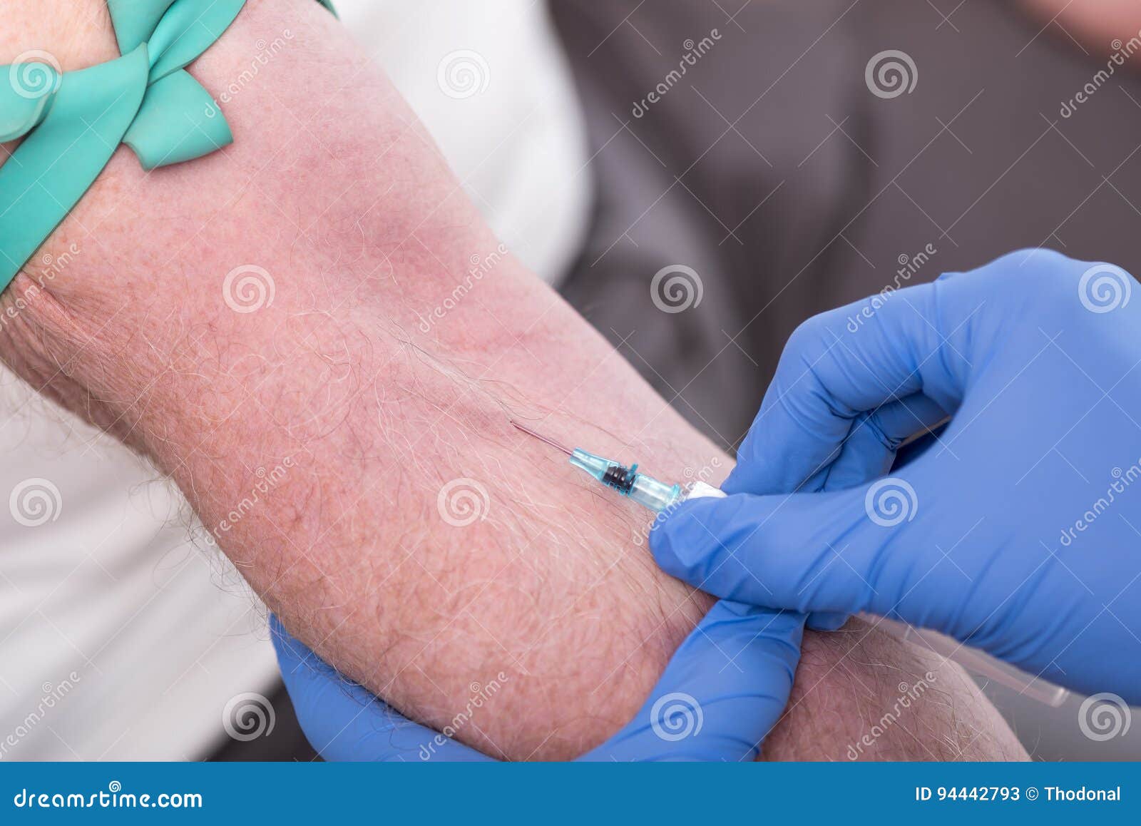 Injection of a Catheter in the Arm Stock Image Image of needle