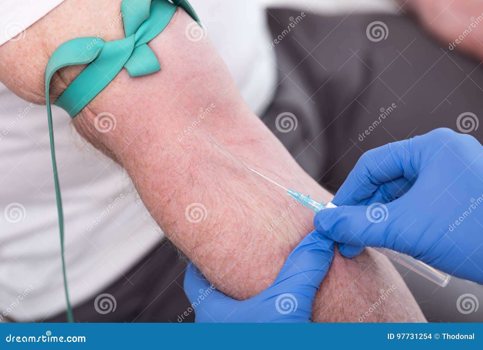 Injection of a Catheter in the Arm Stock Photo Image of tool, glove