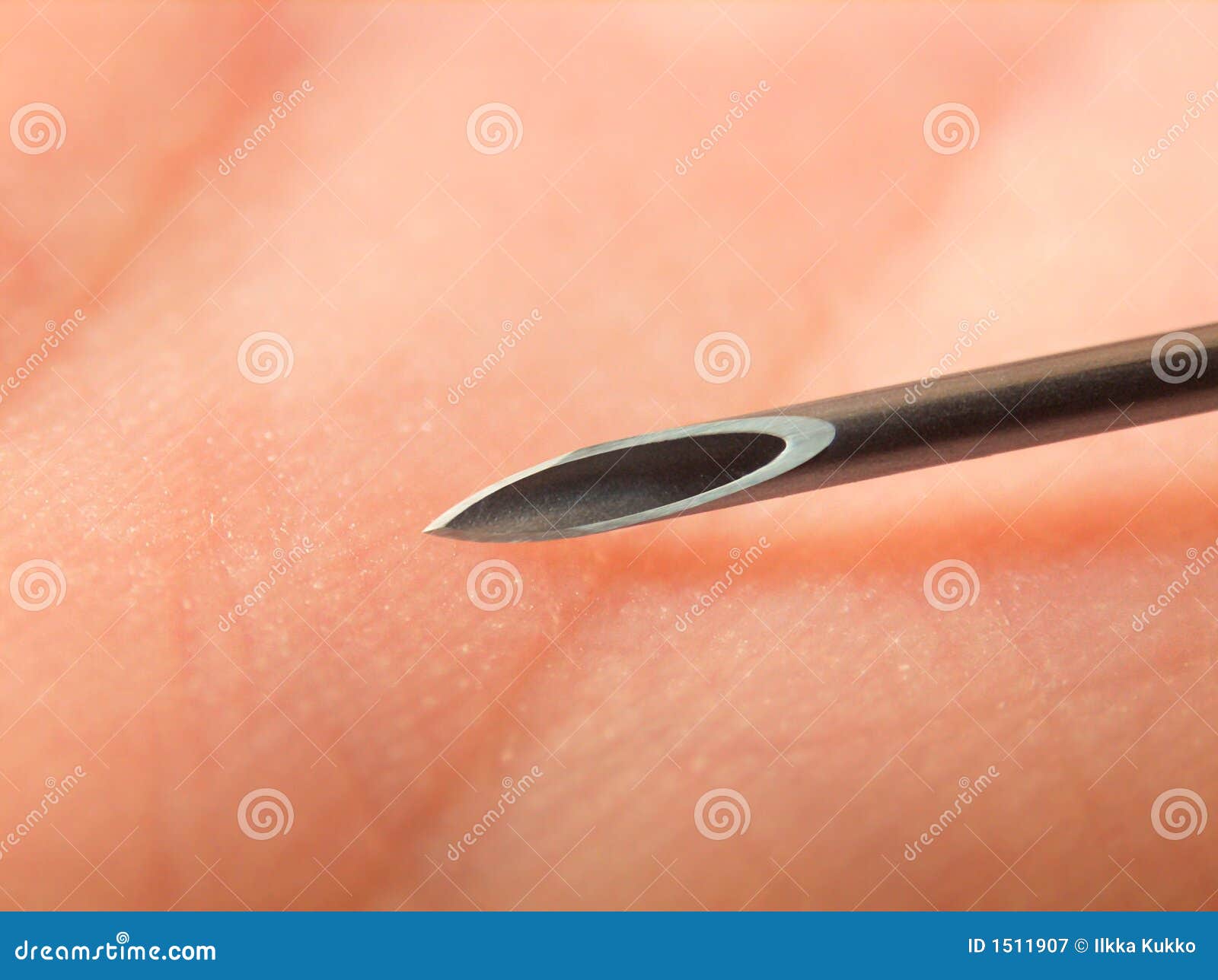 Injection needle on skin stock image. Image of illness 1511907