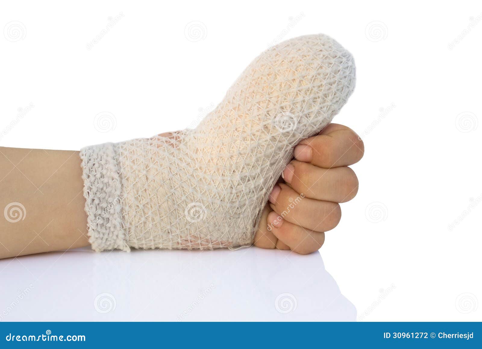 Injured arm stock photo. Image of pain, physical, little - 30961272