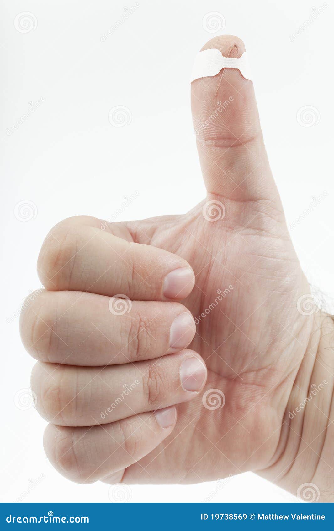 Injured thumb with bandage stock image. Image of thumb 19738569