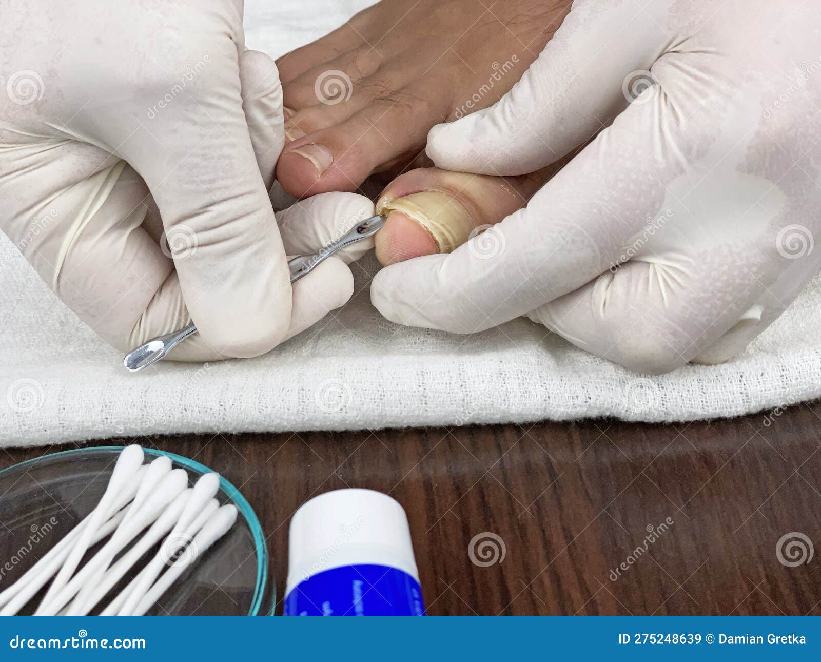 Inspection of the Nails in the Foot by the Doctor Stock Image Image of gloves, injection