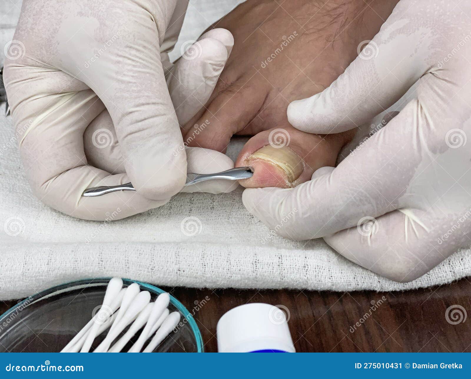 Inspection of the Nails in the Foot by the Doctor Stock Image Image of clinic, hands 275010431