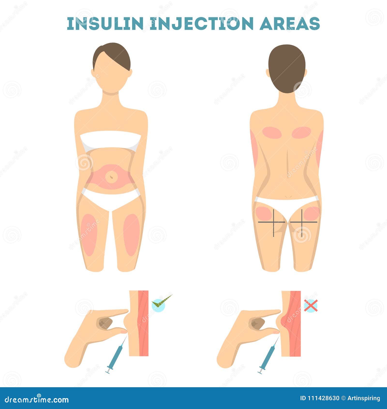 insulin injections places.