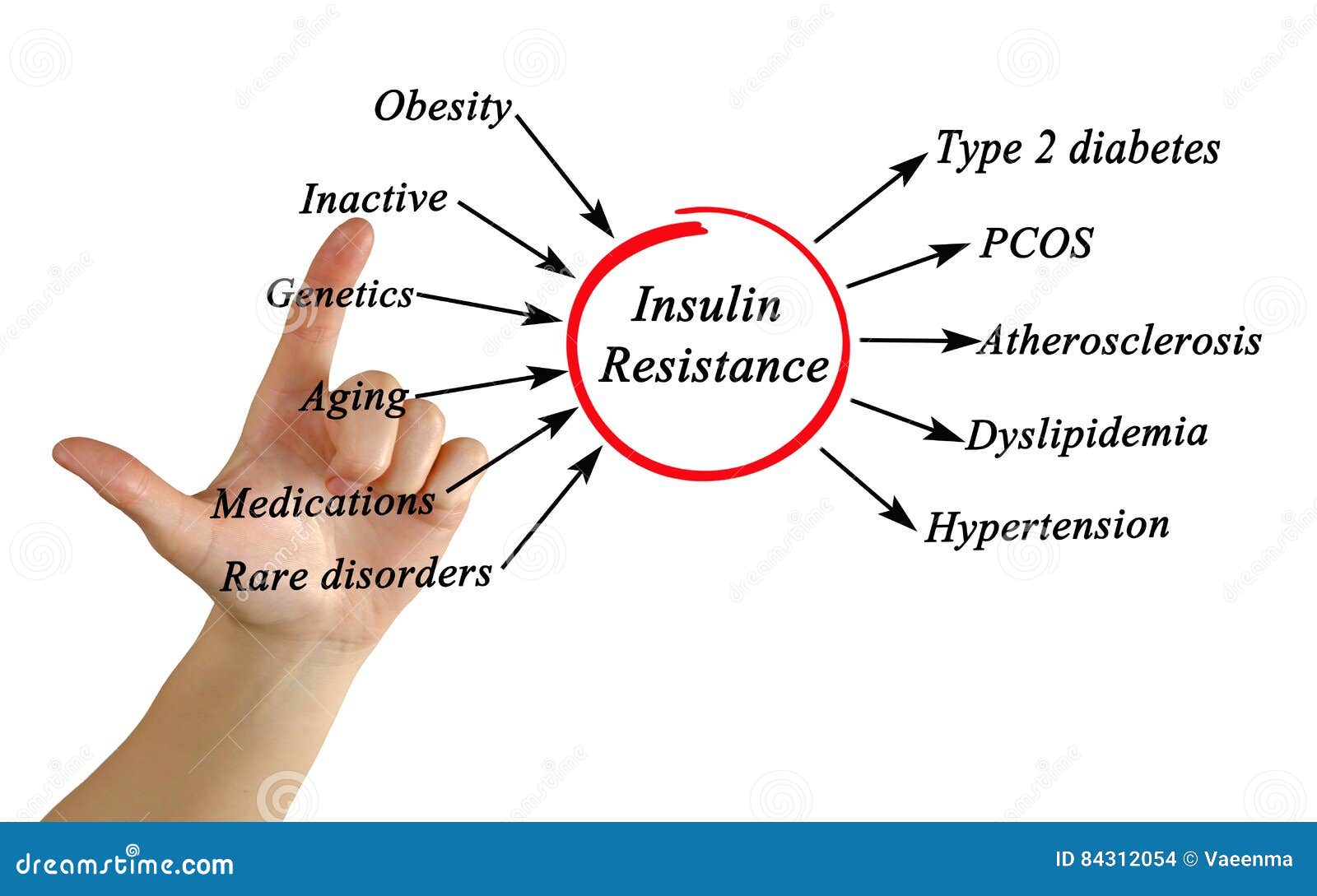 Insulinoresistenza fotografia stock. Immagine di diabete 84312054