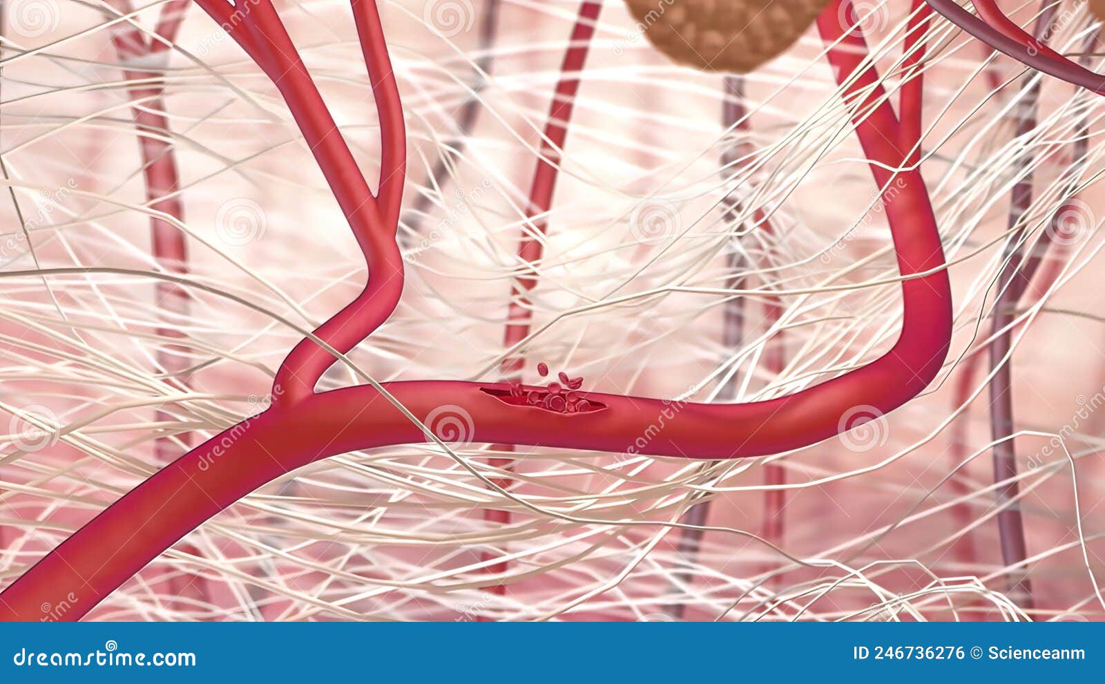 Internal Bleeding is One of the Most Serious Consequences of Trauma