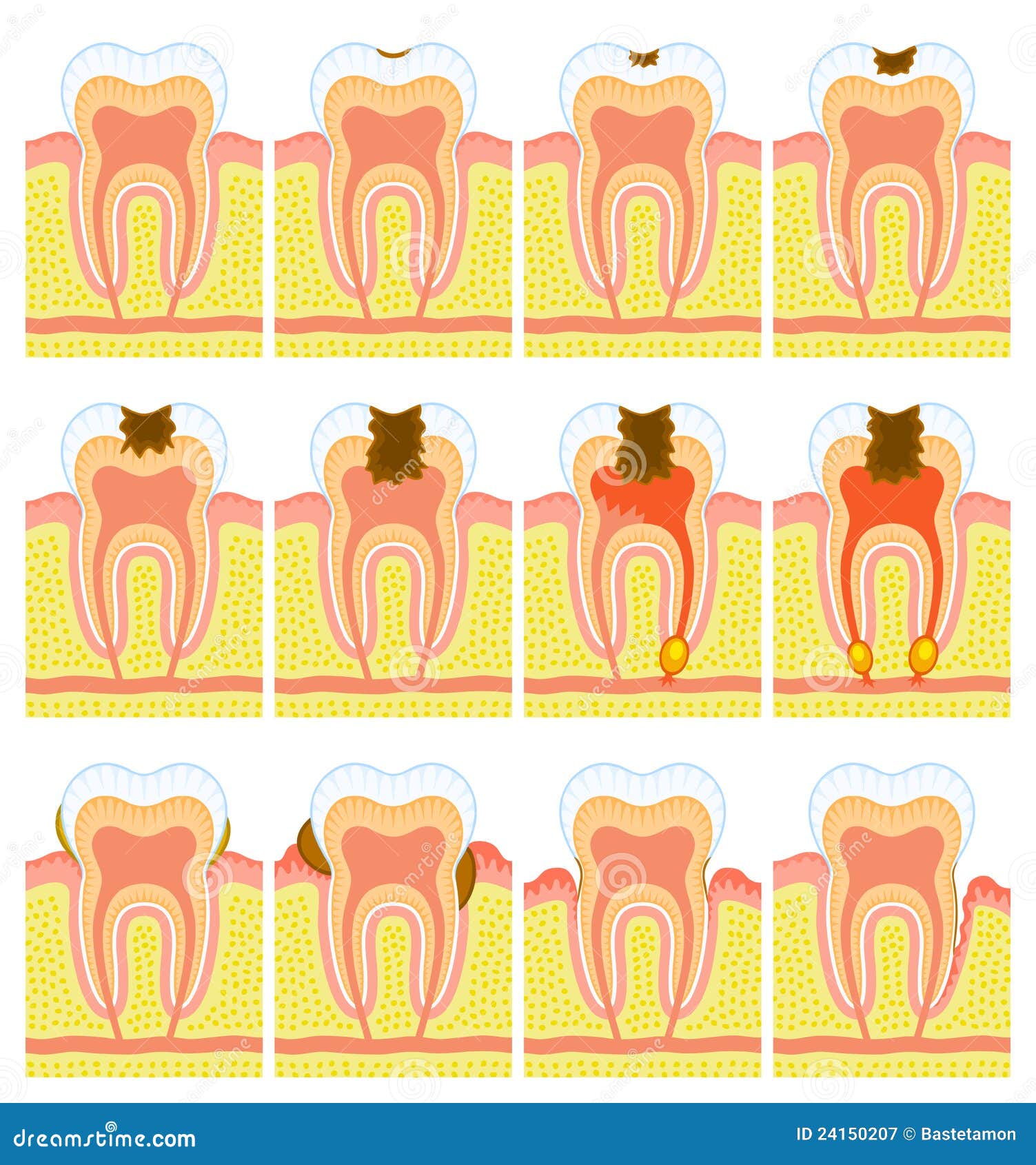 internal structure of tooth